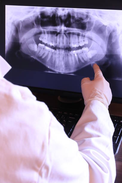 Best Emergency Denture Repair in Lebanon, OH